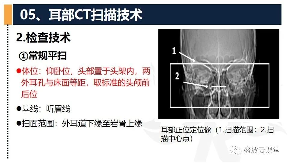 影像PPT - 【PPT】CT检查技术-4