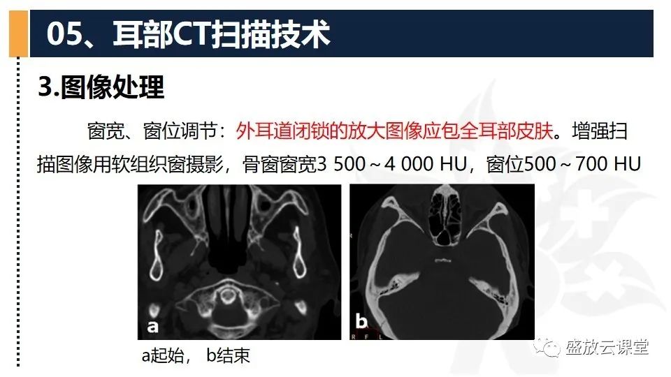 影像PPT - 【PPT】CT检查技术-7
