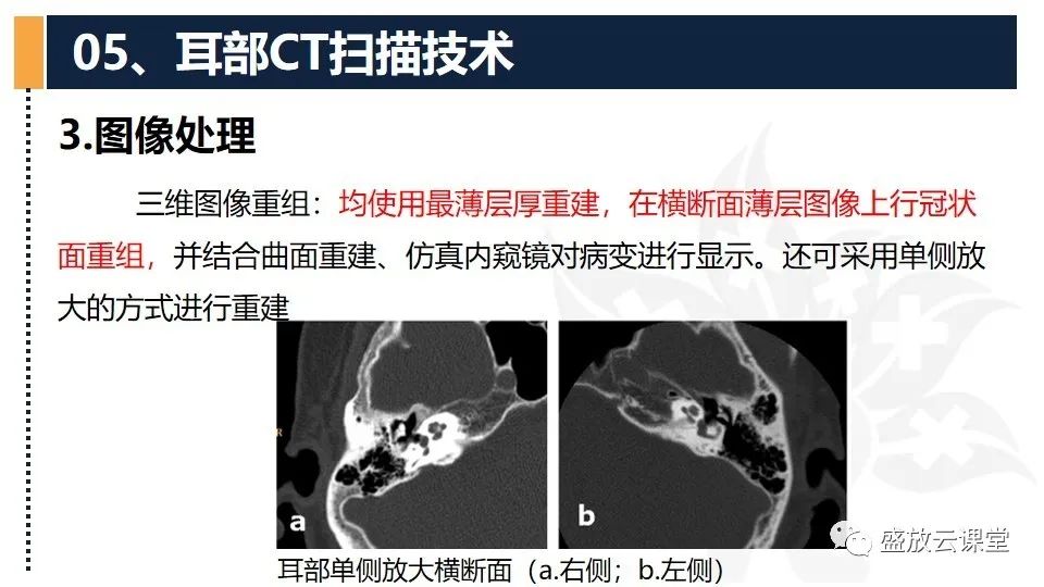 影像PPT - 【PPT】CT检查技术-8
