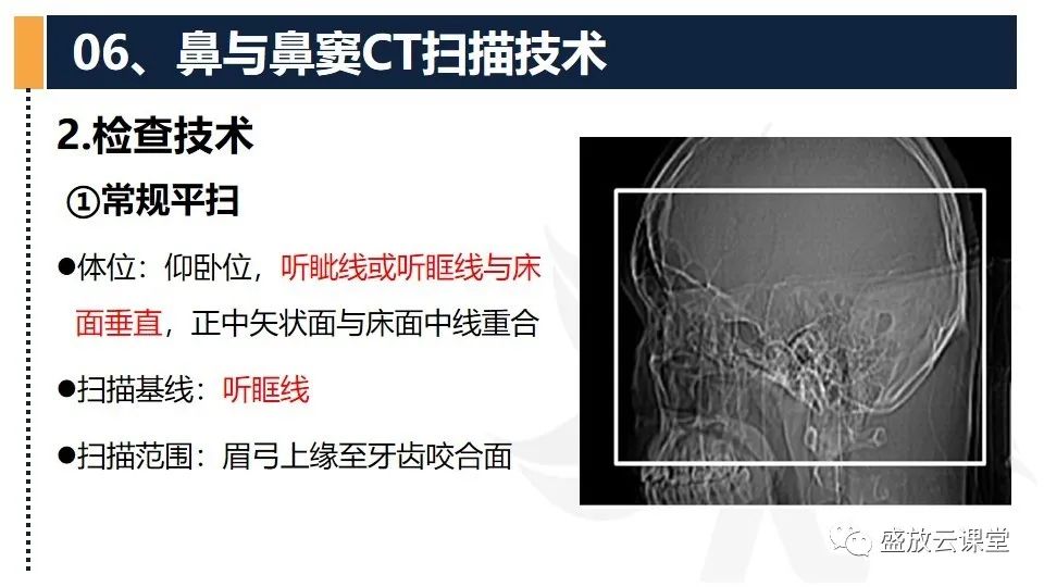 影像PPT - 【PPT】CT检查技术-11