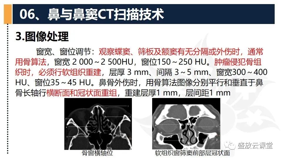 影像PPT - 【PPT】CT检查技术-14