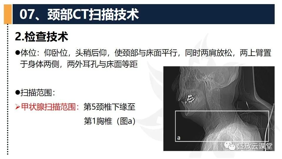 影像PPT - 【PPT】CT检查技术-18