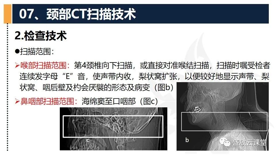 影像PPT - 【PPT】CT检查技术-19