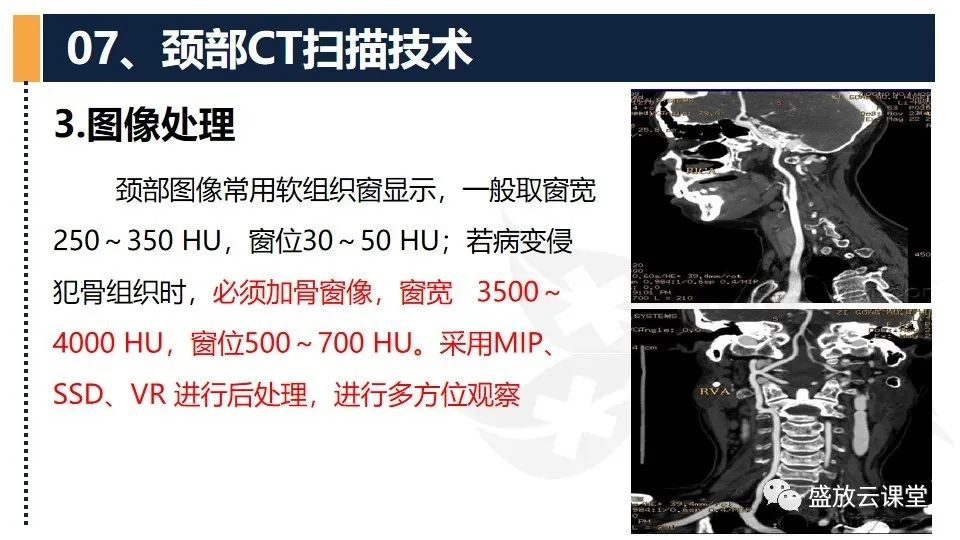 影像PPT - 【PPT】CT检查技术-23