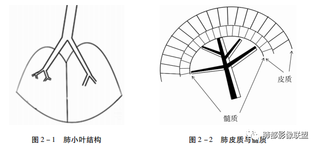 影像PPT - 新冠肺炎分布特征及影像综合分析-1 影像PPT - 新冠肺炎分布特征及影像综合分析-1