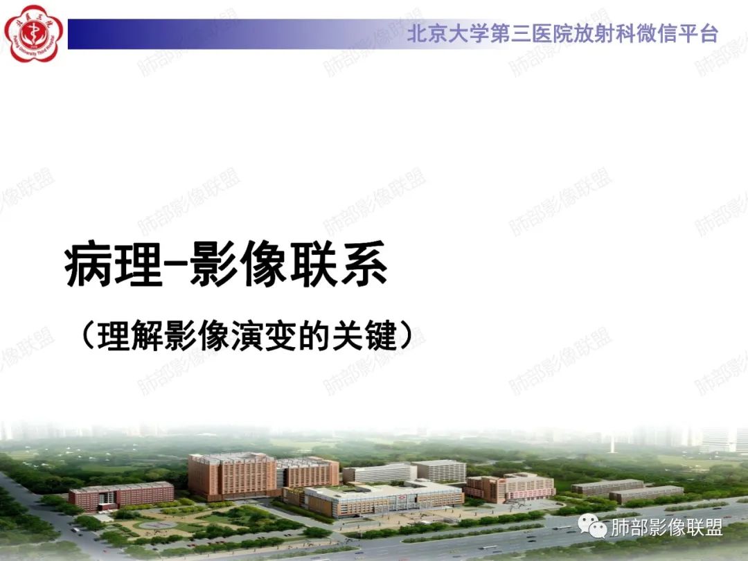 影像PPT - 【PPT】新冠肺炎CT影像表现-4