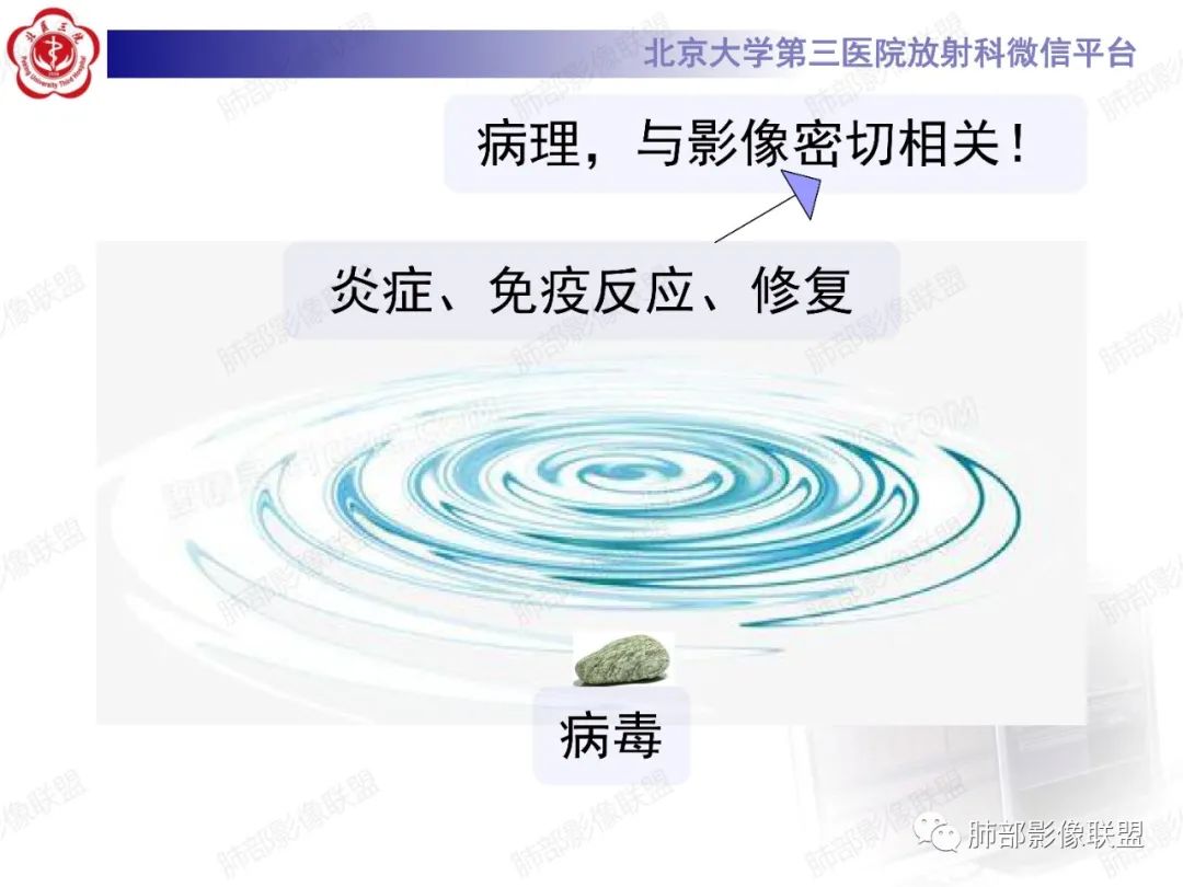 影像PPT - 【PPT】新冠肺炎CT影像表现-5