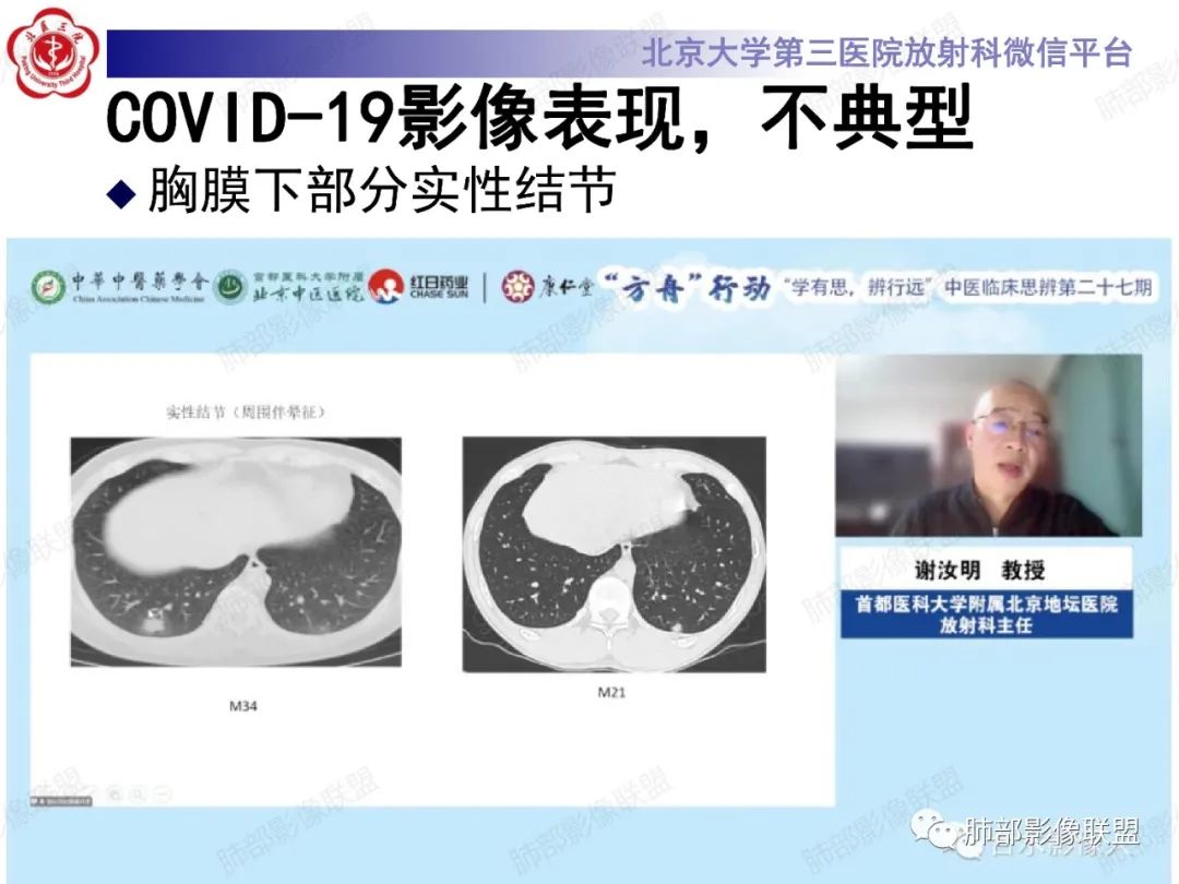 影像PPT - 【PPT】新冠肺炎CT影像表现-26