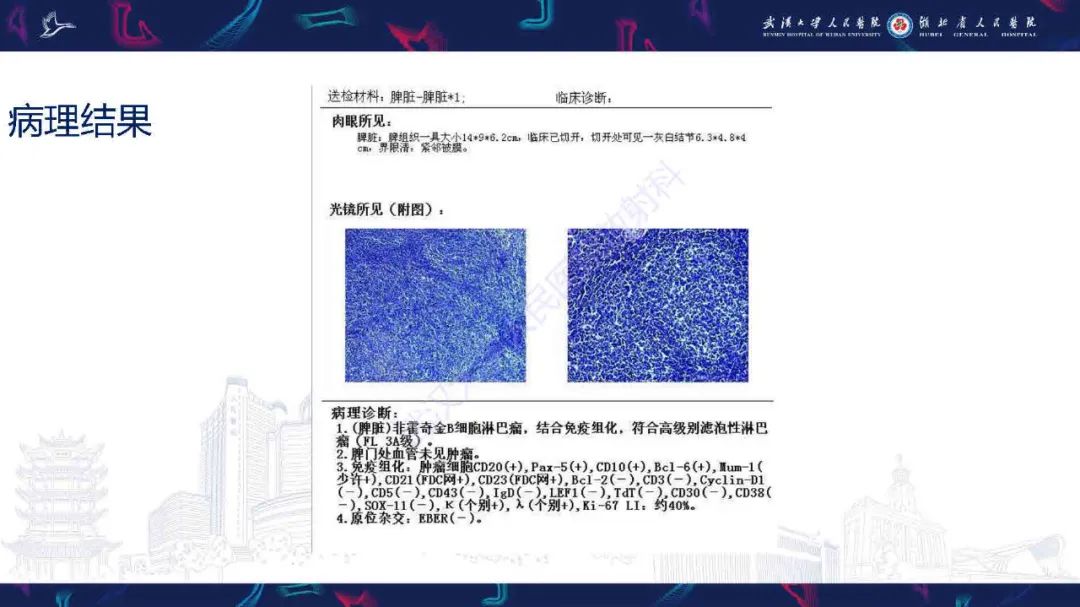 影像PPT - 【PPT】成人脾脏非创伤性病变影像诊断-4