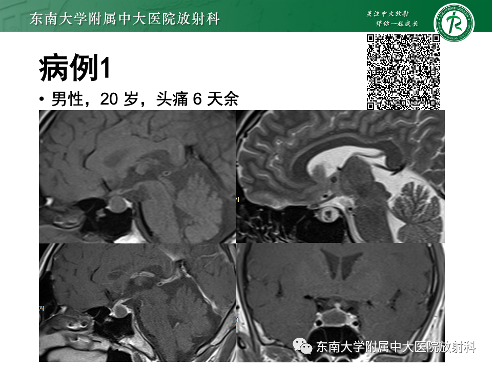 影像PPT - 【PPT】常见鞍内占位影像诊断-1