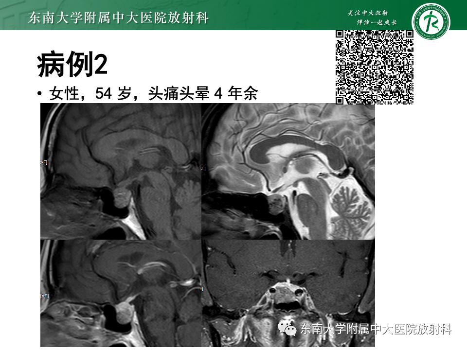 影像PPT - 【PPT】常见鞍内占位影像诊断-2