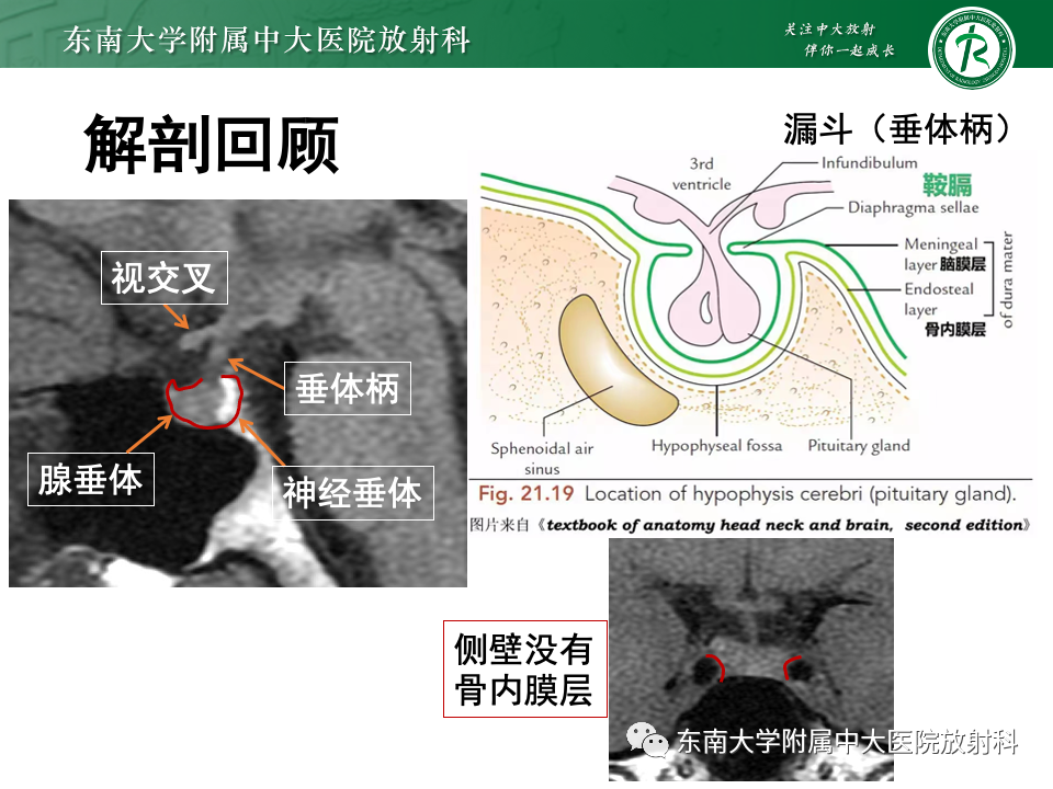 影像PPT - 【PPT】常见鞍内占位影像诊断-9