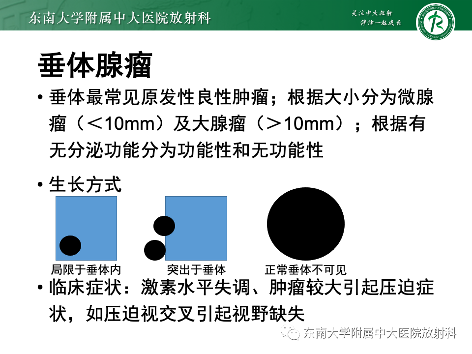 影像PPT - 【PPT】常见鞍内占位影像诊断-12