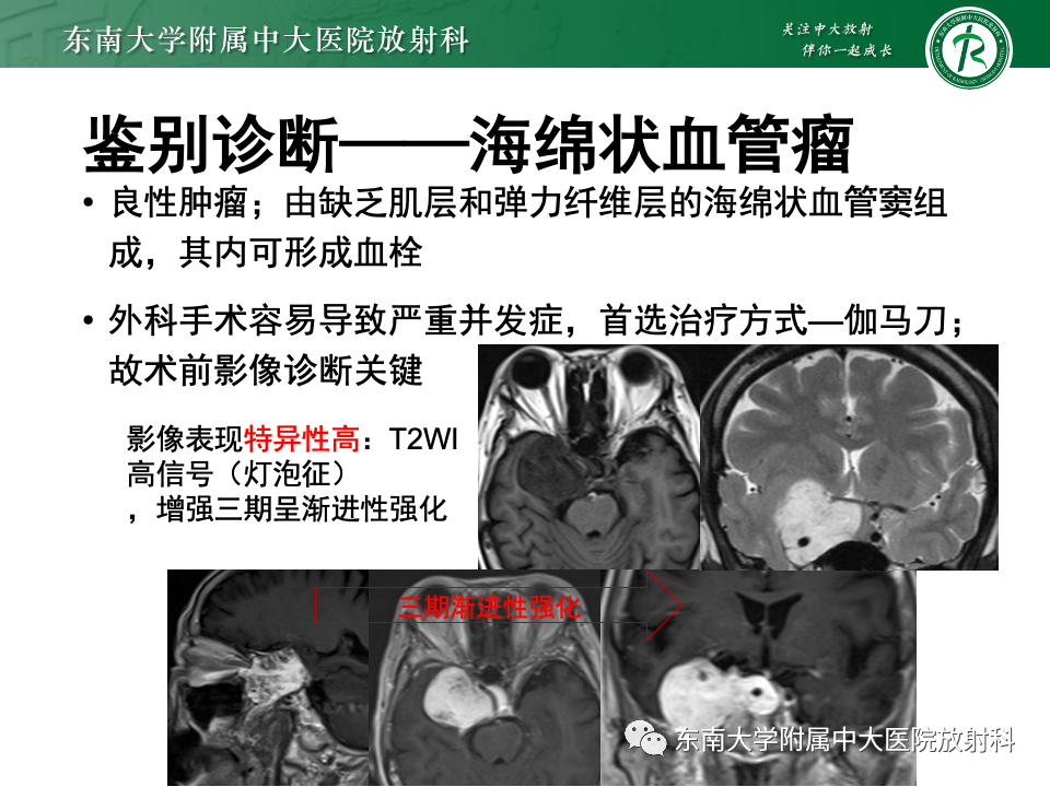影像PPT - 【PPT】常见鞍内占位影像诊断-15