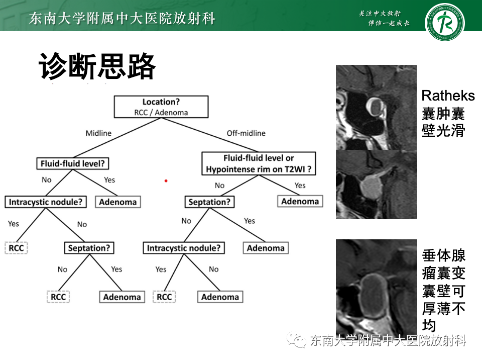 影像PPT - 【PPT】常见鞍内占位影像诊断-20
