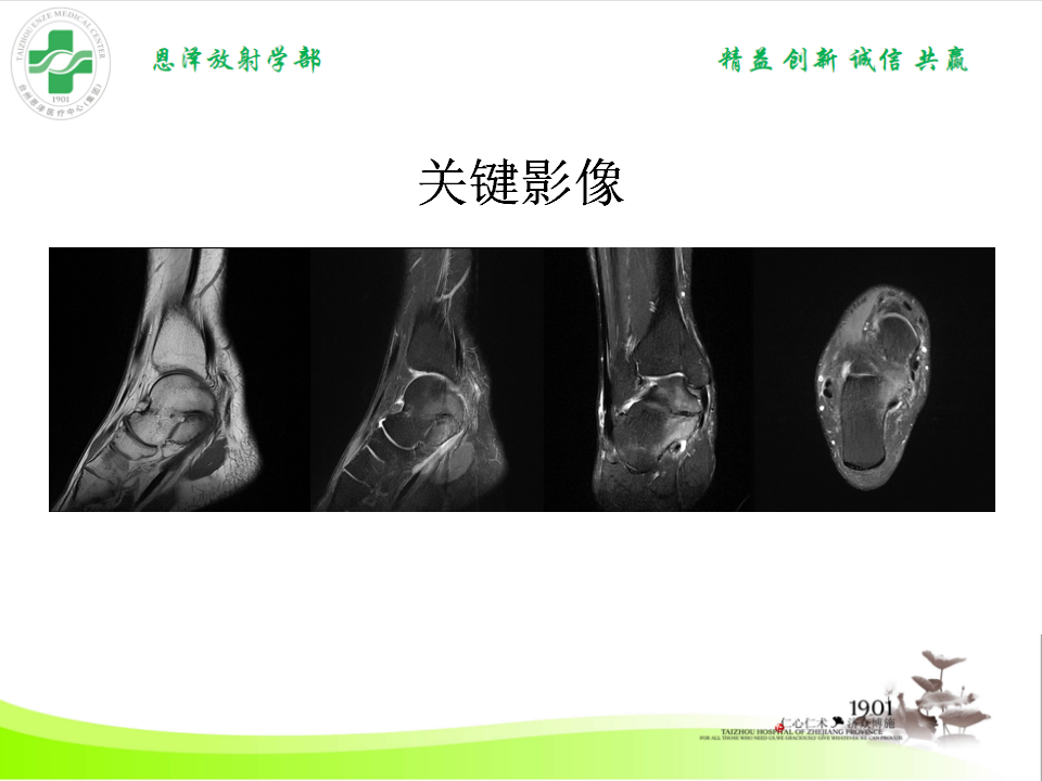 影像PPT - 【PPT】跟骨距骨桥-3