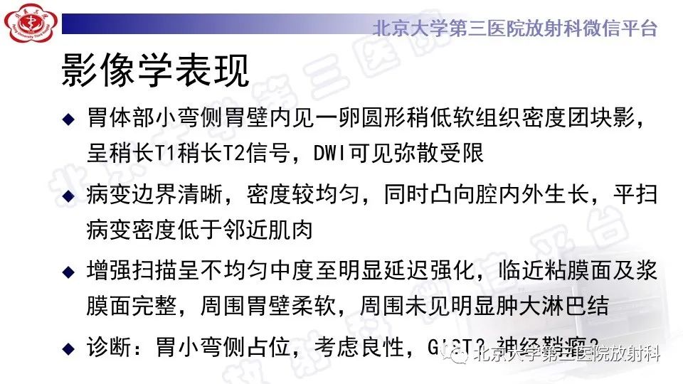 影像PPT - 【PPT】胃神经鞘瘤-8