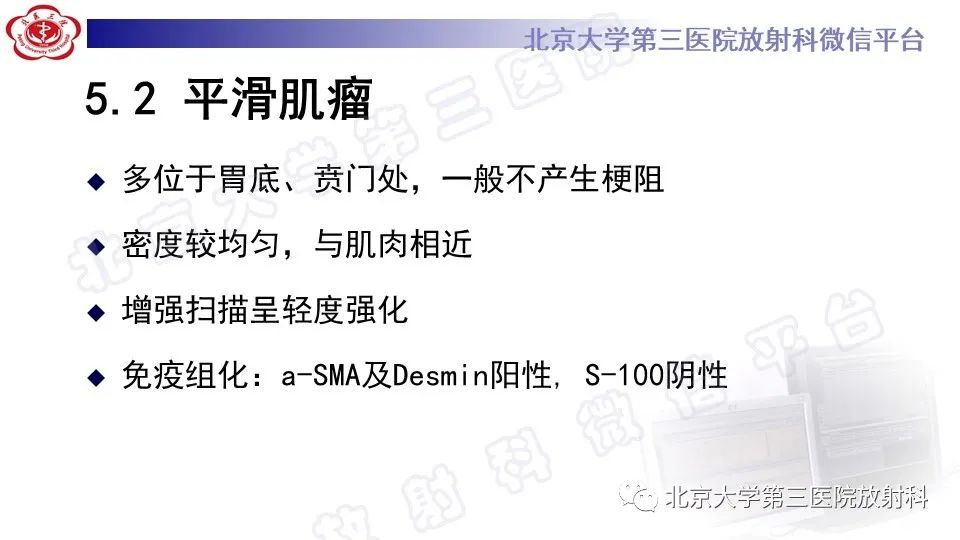 影像PPT - 【PPT】胃神经鞘瘤-22