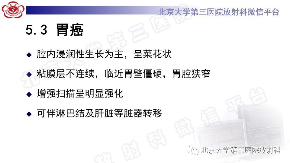 影像PPT - 【PPT】胃神经鞘瘤-23