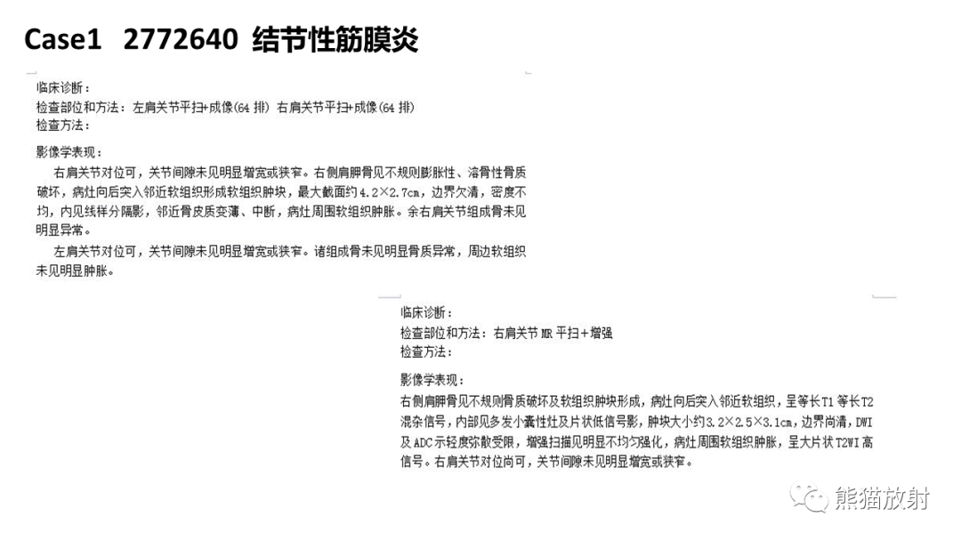影像PPT - 【病例】结节性筋膜炎2例CT及MR影像-13