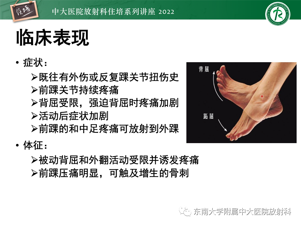 影像PPT - 【PPT】踝关节撞击综合征-8