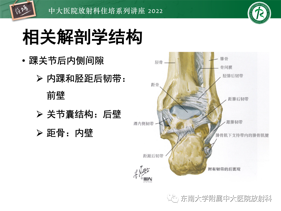 影像PPT - 【PPT】踝关节撞击综合征-40