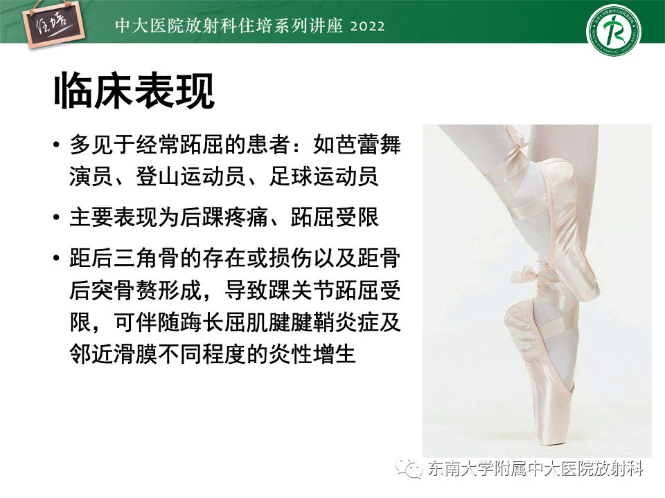 影像PPT - 【PPT】踝关节撞击综合征-53