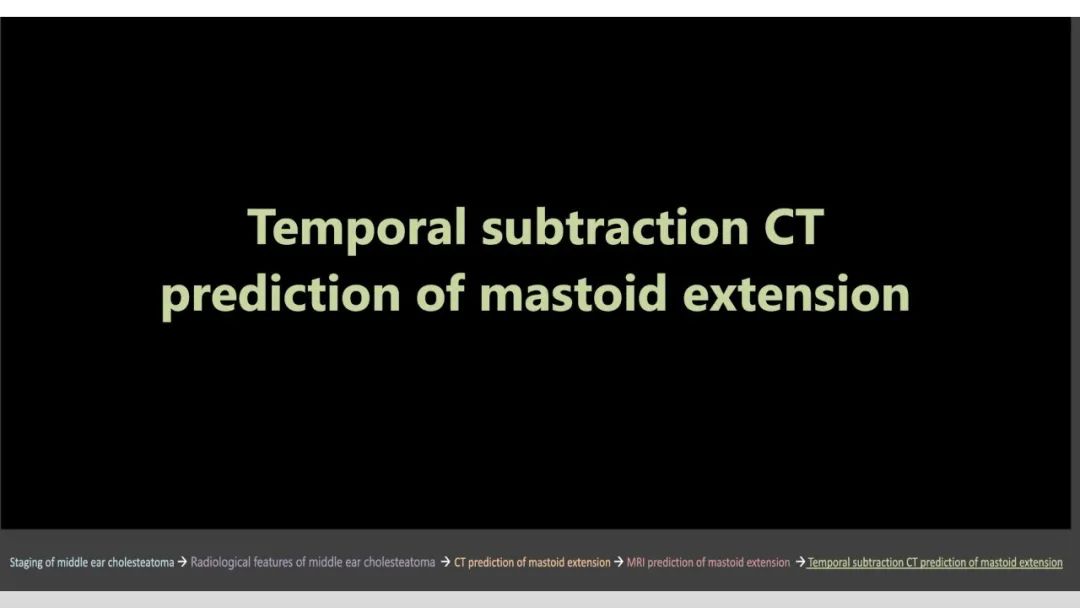 影像PPT - 【PPT】影像学方法术前预测中耳胆脂瘤的乳突侵犯-2