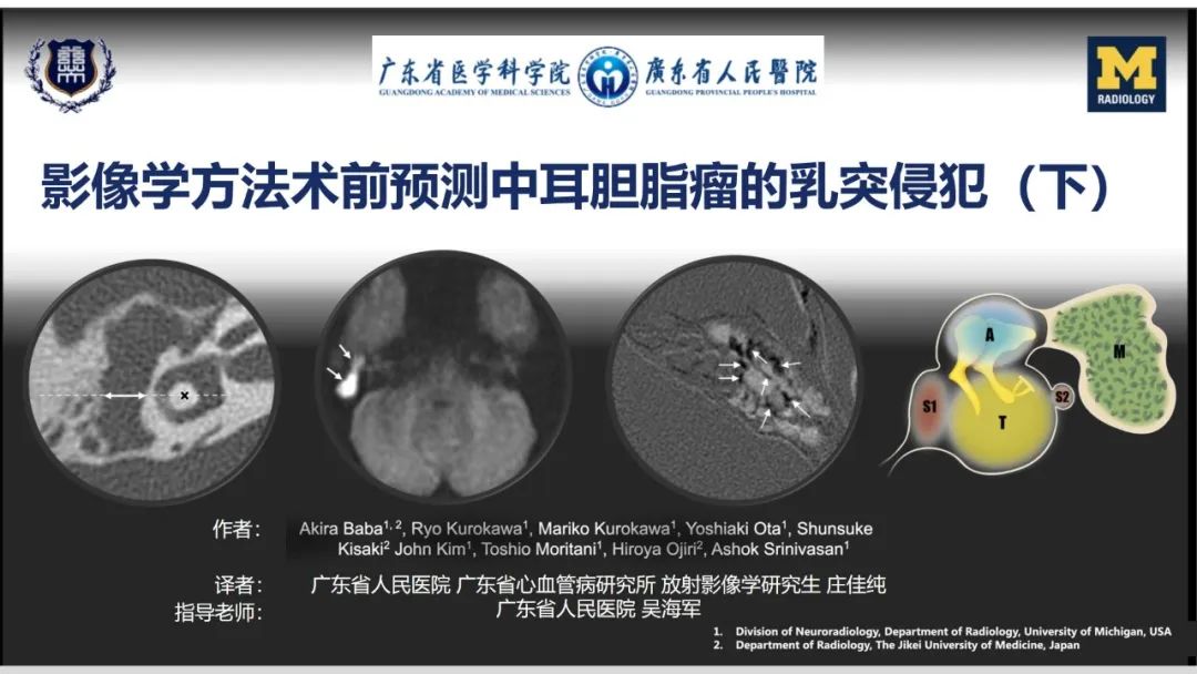 影像PPT - 【PPT】影像学方法术前预测中耳胆脂瘤的乳突侵犯-1