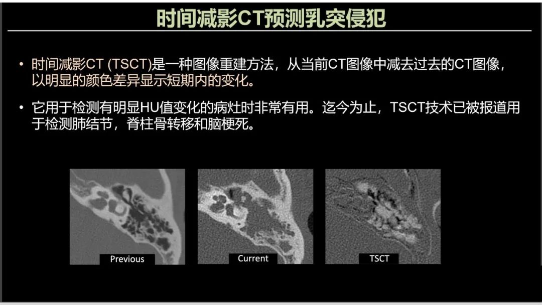影像PPT - 【PPT】影像学方法术前预测中耳胆脂瘤的乳突侵犯-5