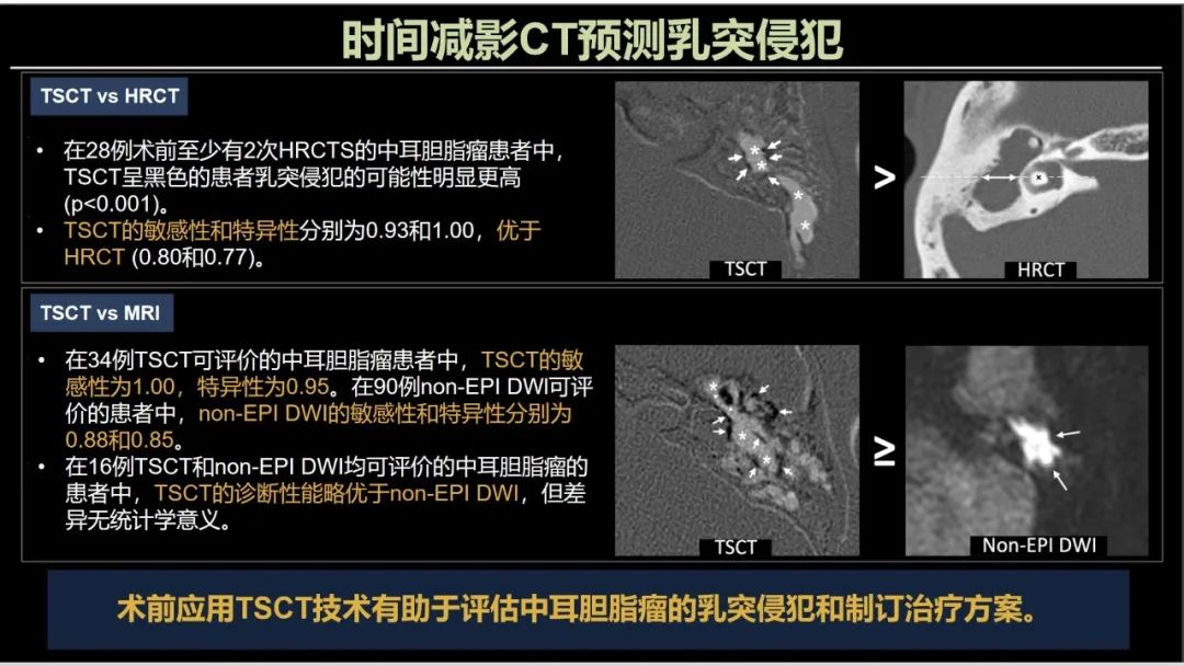 影像PPT - 【PPT】影像学方法术前预测中耳胆脂瘤的乳突侵犯-15