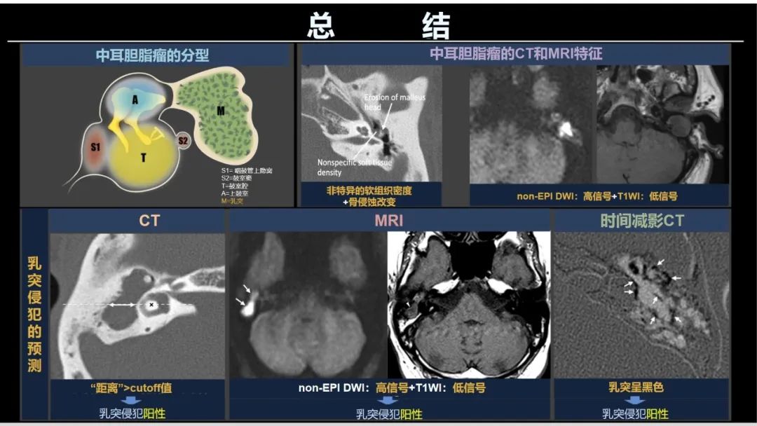 影像PPT - 【PPT】影像学方法术前预测中耳胆脂瘤的乳突侵犯-17