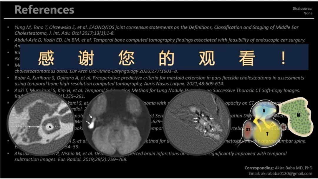 影像PPT - 【PPT】影像学方法术前预测中耳胆脂瘤的乳突侵犯-21