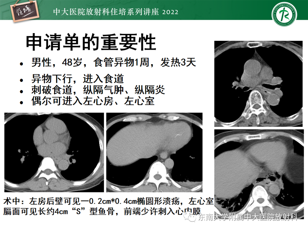 影像PPT - 【PPT】影像急诊易漏诊病变总结-6
