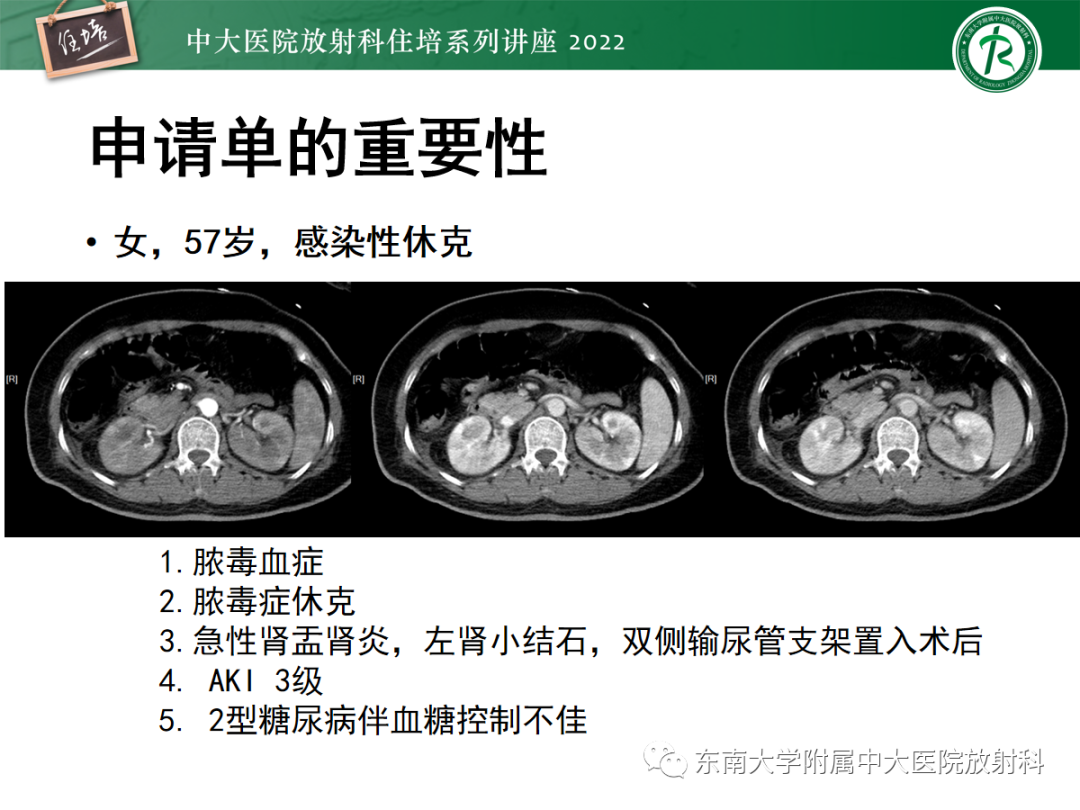 影像PPT - 【PPT】影像急诊易漏诊病变总结-7