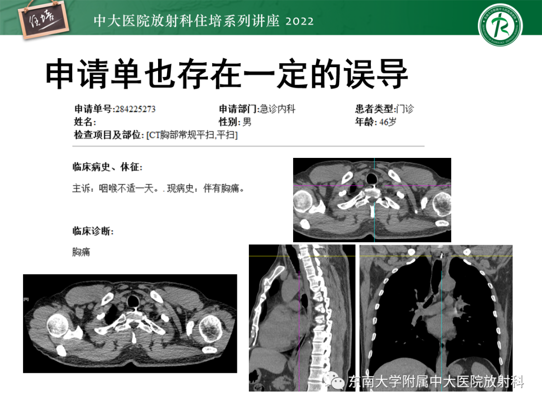 影像PPT - 【PPT】影像急诊易漏诊病变总结-8