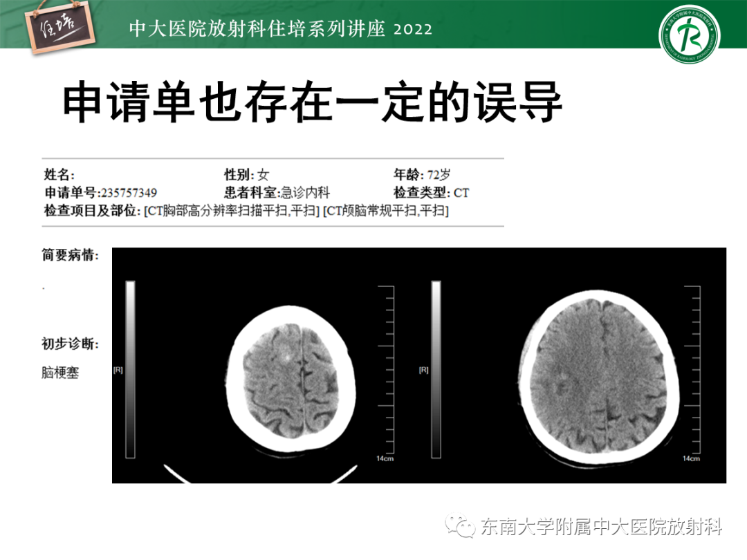 影像PPT - 【PPT】影像急诊易漏诊病变总结-9