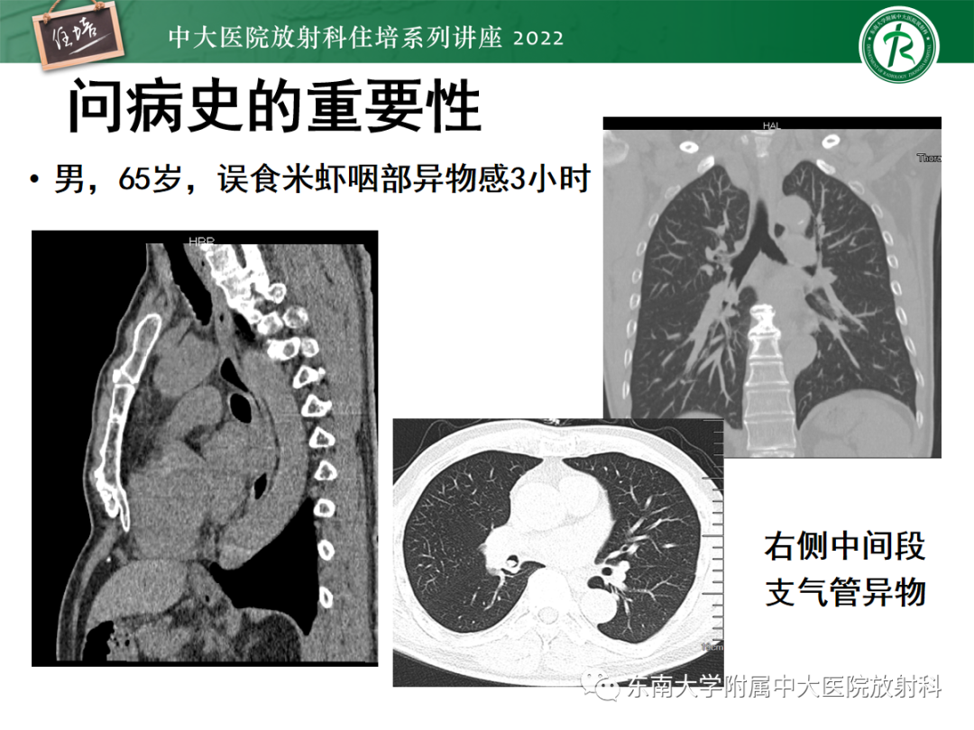 影像PPT - 【PPT】影像急诊易漏诊病变总结-11