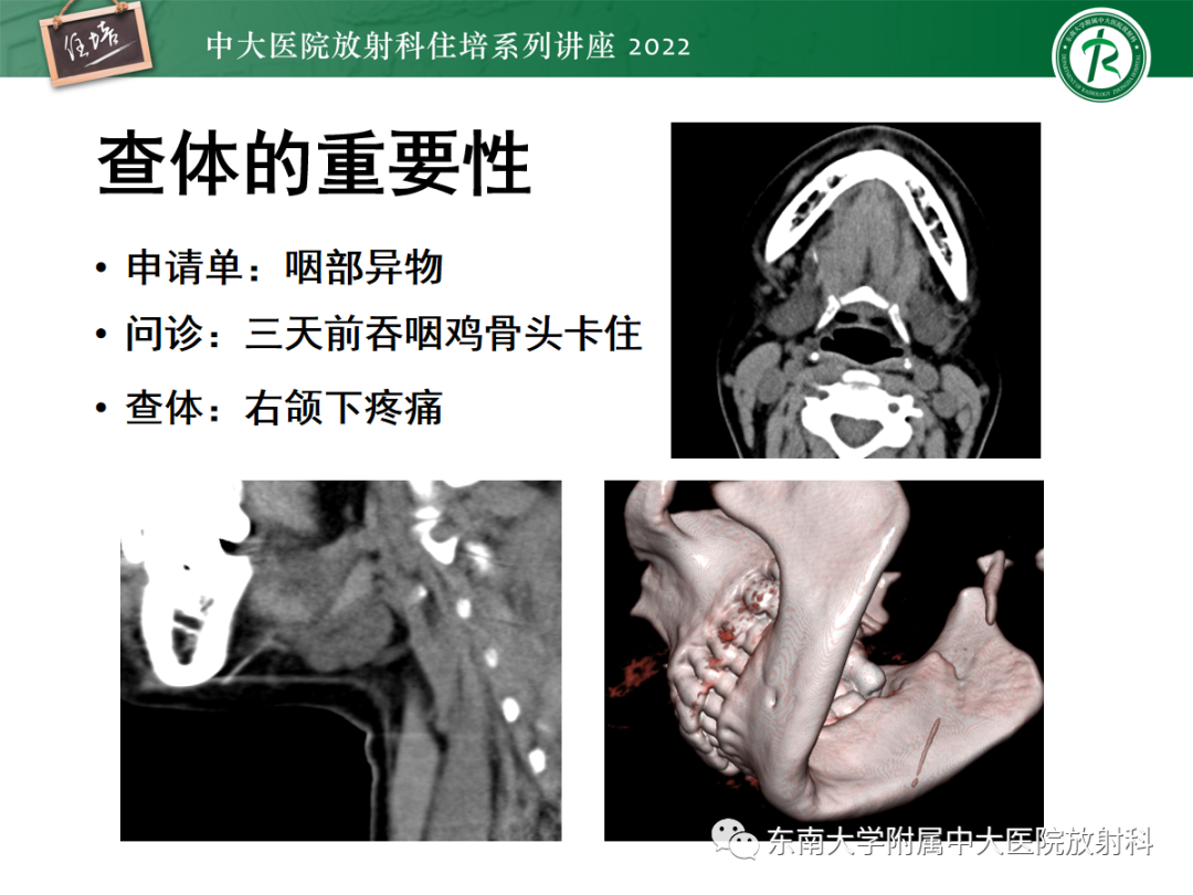 影像PPT - 【PPT】影像急诊易漏诊病变总结-12