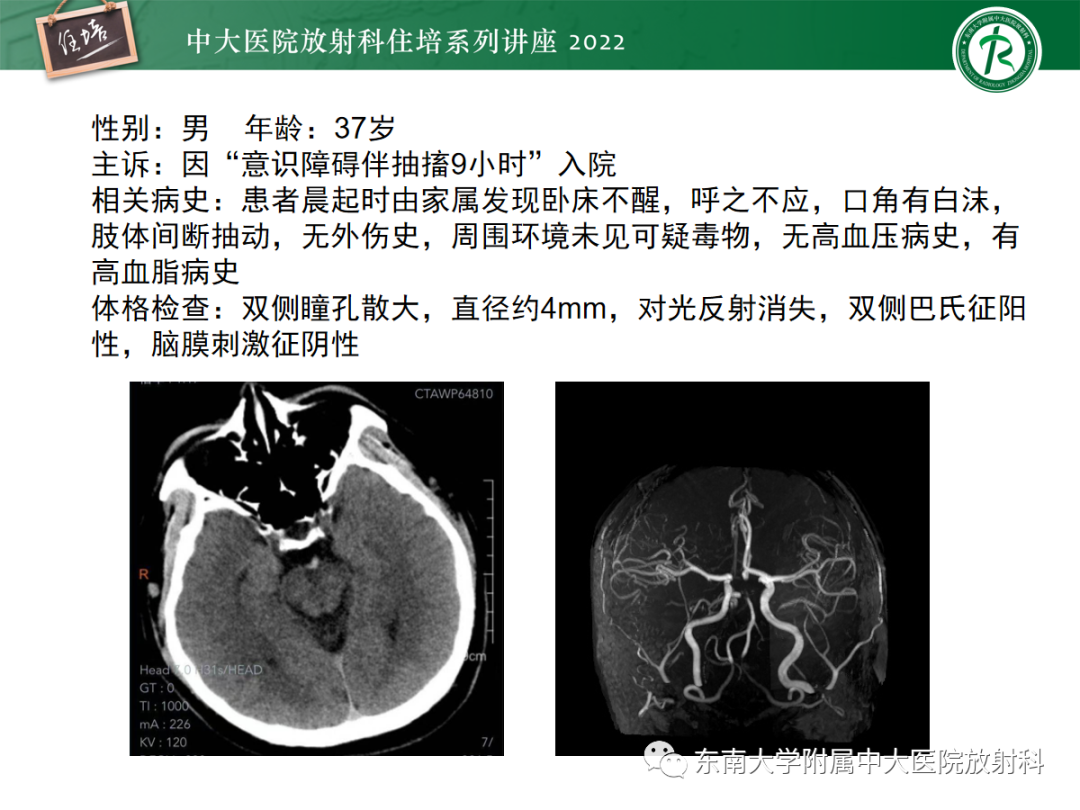 影像PPT - 【PPT】影像急诊易漏诊病变总结-20