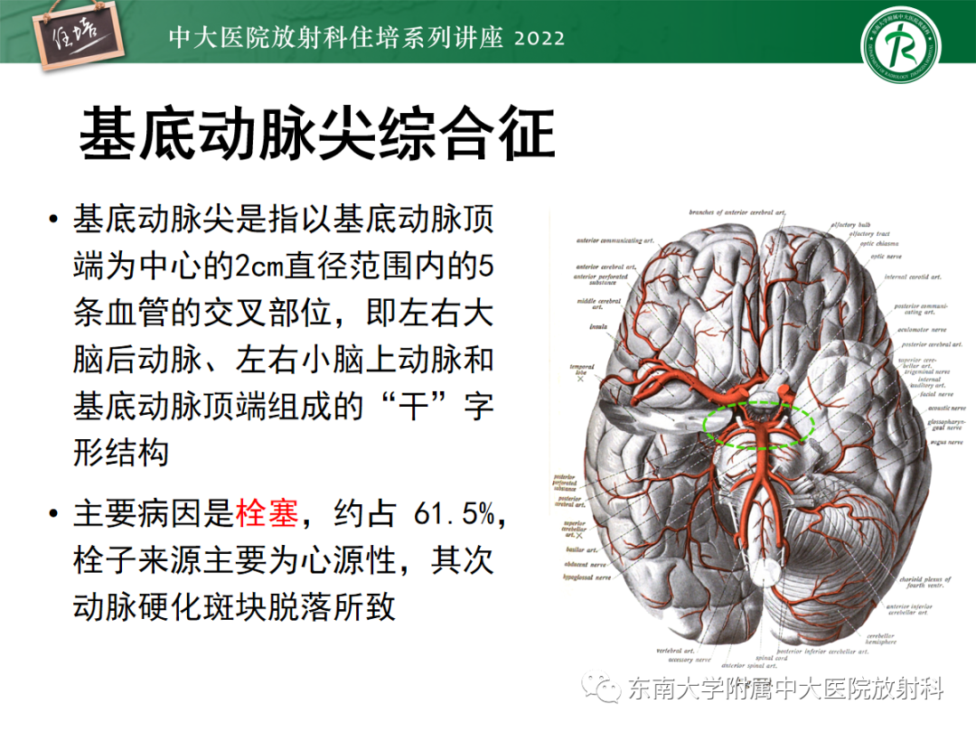 影像PPT - 【PPT】影像急诊易漏诊病变总结-22