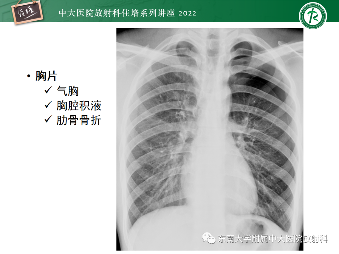 影像PPT - 【PPT】影像急诊易漏诊病变总结-26