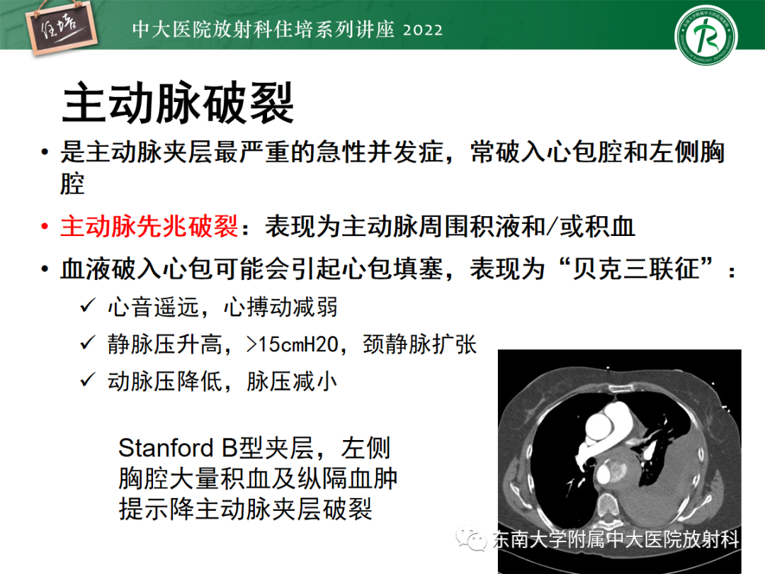 影像PPT - 【PPT】影像急诊易漏诊病变总结-35
