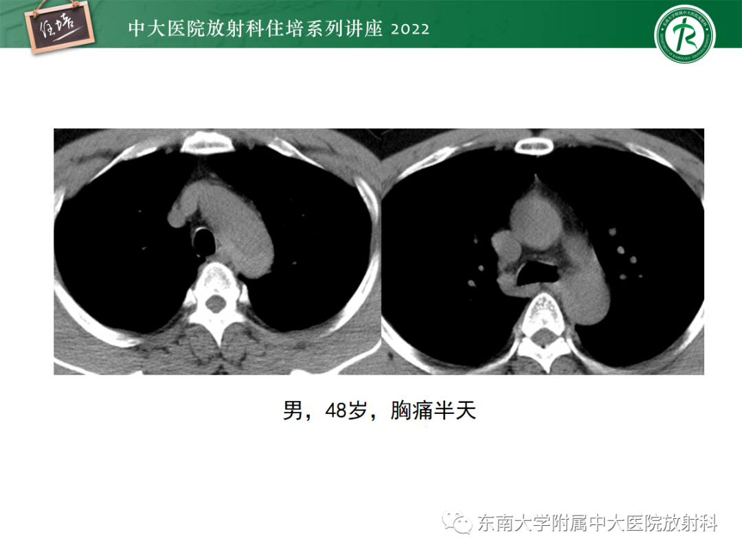 影像PPT - 【PPT】影像急诊易漏诊病变总结-41