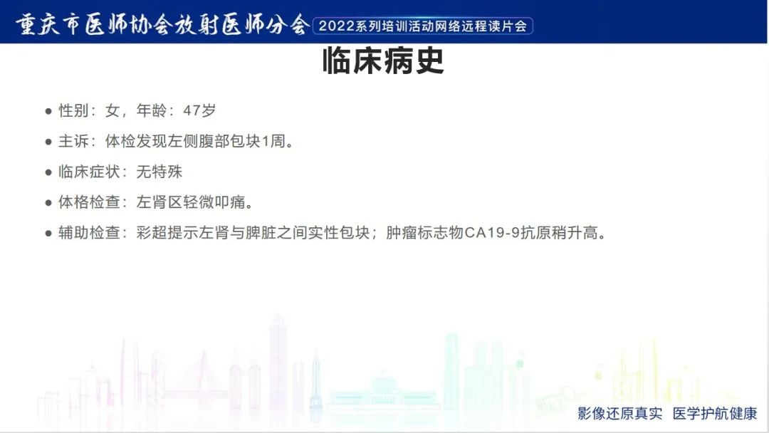 影像PPT - 【病例】肾上腺皮质嗜酸细胞腺瘤1例CT-2