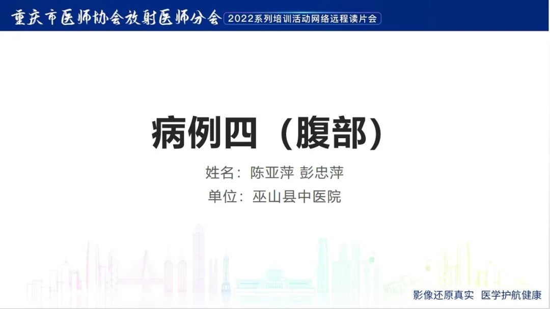 影像PPT - 【病例】肾上腺皮质嗜酸细胞腺瘤1例CT-1
