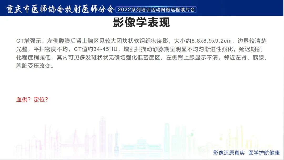 影像PPT - 【病例】肾上腺皮质嗜酸细胞腺瘤1例CT-8
