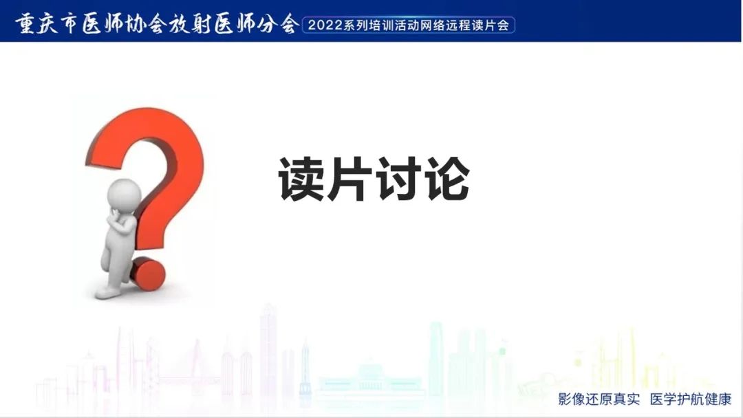 影像PPT - 【病例】肾上腺皮质嗜酸细胞腺瘤1例CT-9