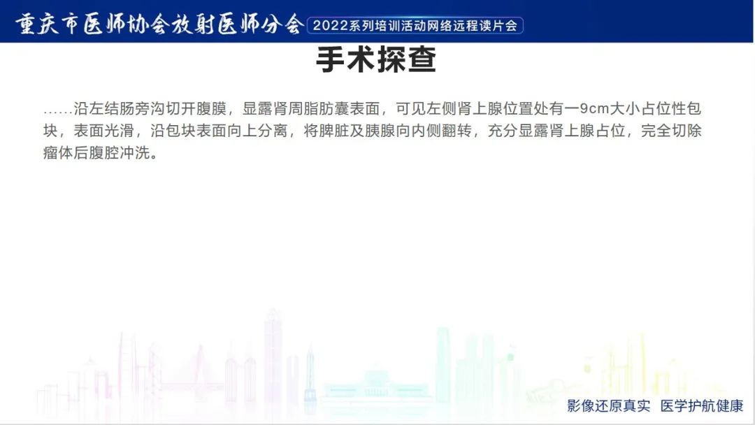 影像PPT - 【病例】肾上腺皮质嗜酸细胞腺瘤1例CT-10