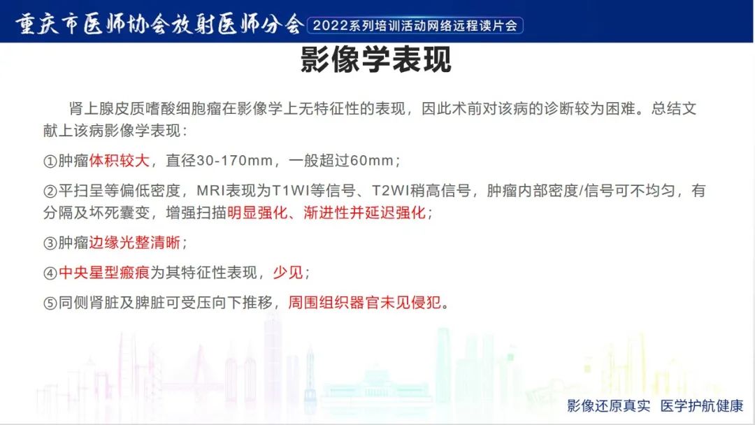 影像PPT - 【病例】肾上腺皮质嗜酸细胞腺瘤1例CT-17